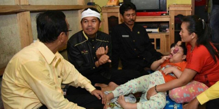 Ciamis Regent Iing Syam Arifin (left) and Purwakarta Regent Dedi Mulyadi (second left) visit Oktaviani, a 6-year-old born with a   malformed face. She is held by her mother, Tati Nurhayati (right), in Banjarsari, Ciamis, West Java.