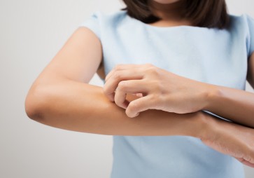 Science may have answer to the itch you shouldn't scratch