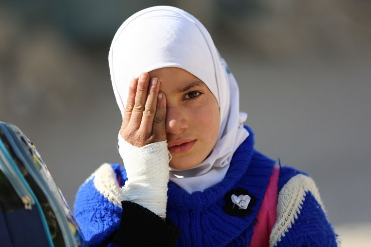 A girl poses covering one eye with her hand in the rebel-held town of Douma in Syria's besieged eastern Ghouta region, on Dec. 18, 2017, as part of a campaign in solidarity with a baby boy, Karim Abdallah, who lost an eye, as well as his mother, in government shelling on the nearby town of Hammouria.
