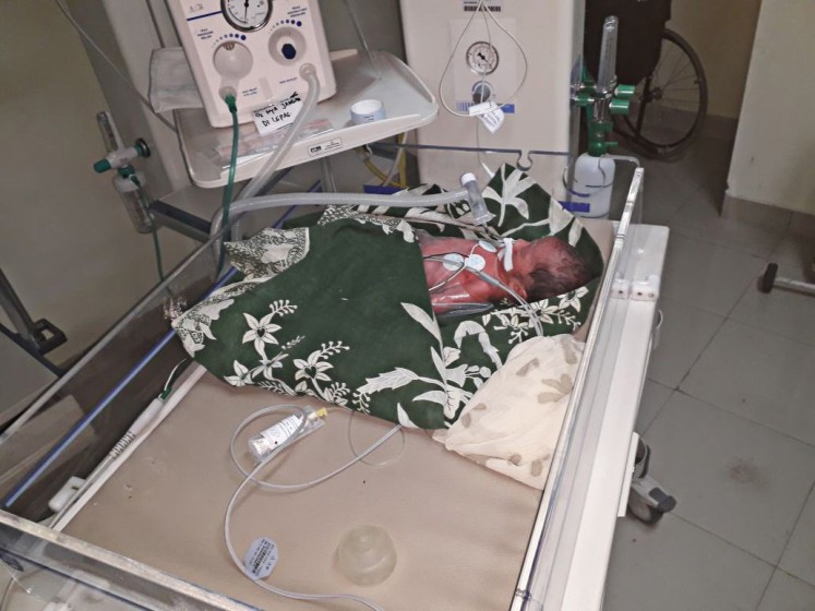 A baby boy, born during a computer-based Joint Entrance Test for State Universities (SBMPTN), receives intensive medical treatment at University of Hasanuddin Hospital in Makassar, South Sulawesi. 