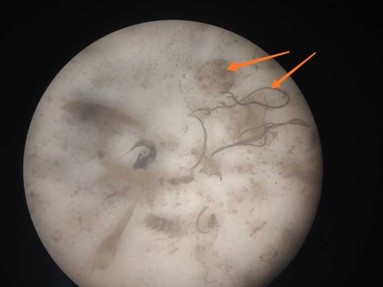 A microscopic picture of the stomach of a fish taken from the Brantas River shows the fish had ingested plastic fibers and fragments.