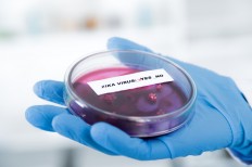 Zika can also affect adult brain: Study 