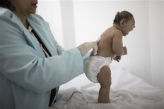 CDC: Zika definitely causes severe birth defects 