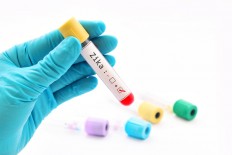 Monkey study finds Zika infection lasts longer in pregnancy 