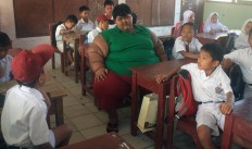Karawang teenager to have excess skin removed after obesity treatment