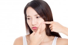 Study looks into vaccination to prevent acne 