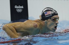 Phelps puts spotlight on cupping