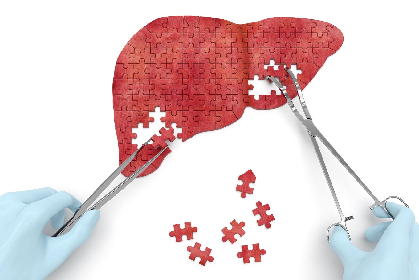 What Happens In The 4 Stages Of Liver Disease Health The
