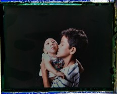 In this Sept. 27, 2016 photo made from a negative recovered from instant film, Elisson Campos poses with his 1-year-old brother, Jose Wesley Campos, who was born with microcephaly, one of many serious medical problems that can be caused by congenital Zika syndrome, in Bonito, Pernambuco state, Brazil. Elisson is very close to his baby brother and loves to hold him in his arms. AP Photo/Felipe Dana
