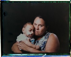 In this Sept. 27, 2016 photo made from a negative recovered from instant film, Solange Ferreira holds her 1-year-old son Jose Wesley Campos, who was born with microcephaly, one of many serious medical problems that can be caused by congenital Zika syndrome, as they pose for a photo in Bonito, Pernambuco state, Brazil. The boy came to be known as the "bucket baby" because of a Dec. 23, 2015 photograph of him in a bucket filled with water to help him calm down. The image became emblematic of Brazil's Zika epidemic amid a surge of babies being born with unusually small heads in the country's northeast. AP Photo/Felipe Dana