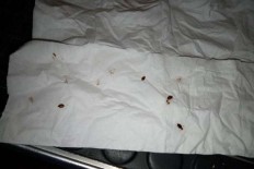 Woman complains of bedbug-infested coach ride from KL to Singapore