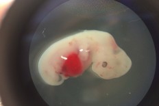 Scientists take first steps to growing human organs in pigs 