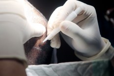 Giving hair a second chance