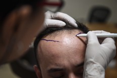 Hair therapy boosts Istanbul's receding tourism