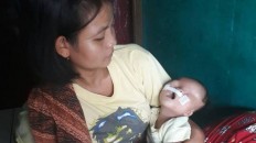 Red tape hampers treatment of Tangerang baby born without eyelids