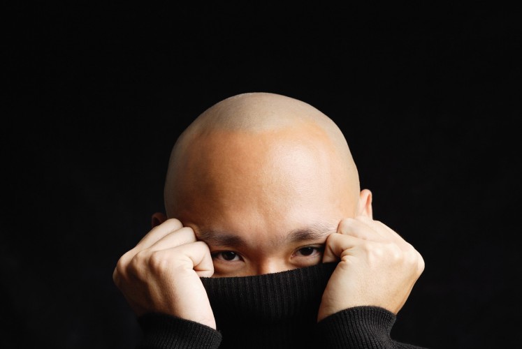 Korean Scientists Discover Potential Cure For Baldness Health The Jakarta Post