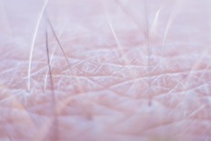 Human form of 'mad cow' disease detectable in skin: study