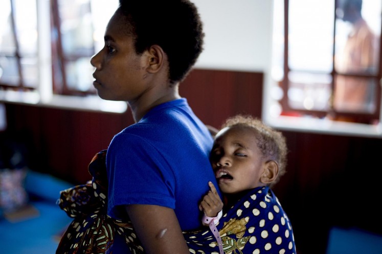 A Papuan mother carries her sleeping child on her back on Jan. 25, 2018, at a temporary hospital handling measles and malnutrition patients in Agats, the capital of Asmat district in Indonesia's easternmost Papua province. Some 800 children have been sickened by a measles-and-malnutrition outbreak in Indonesia's remote Papua province, officials said Jan. 25, with as many as 100 people, mostly toddlers, feared to have been killed in the outbreak. AFP/ Bay Ismoyo