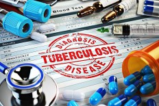 Reinvigorate efforts to end TB 