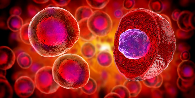 Thanks to a laser-equipped mini-microscope developed by a French start-up, scientists have discovered a previously undetected feature of the human anatomy that could help explain why some cancers spread so quickly.