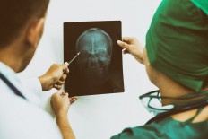 Head injury boosts dementia risk: Study