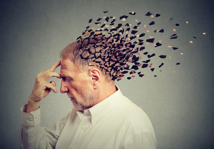 While physical exercise may stave off dementia, it does not delay mental decline in people after they've been diagnosed, a study in nearly 500 people with the condition reported Thursday.