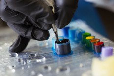 Three years ago, Johanna Giselhäll Sandström wanted a loving reminder of her two kids inked on her skin. However, in the tattoo studio, her son Kevin’s name turned into a Kelvin, reports Blekinge Läns Tidning.