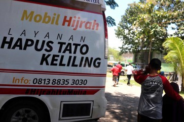 Achieving hijrah perfection by removing tattoos