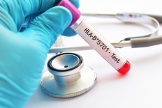 HIV drug shortage hits Indonesian cities, regencies as ministry procures supply 