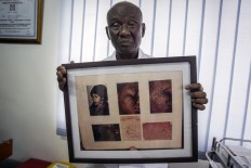 Skin bleaching in Africa: An 'addiction' with risks