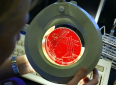 Hospital scientist Joanne Thambyah (L) inspects an unidentified culture (C) in the Microbiology Department of Sydney's Royal North Shore Hospital, 07 June 2004. 