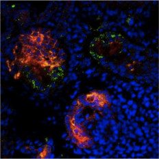 University seeks ban on gene-edited babies