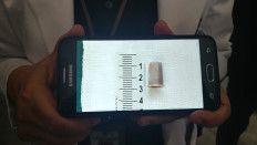 Bandung boy with whistle in airway squeals no more  