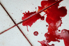 Canada neurosurgeon pleads guilty to murdering wife