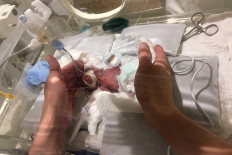 Mini miracle: 'Record-breaking' preemie leaves Tokyo hospital