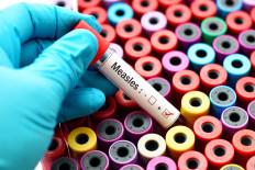 An alarming global surge in measles cases poses a serious threat to children and more efforts are needed to improve vaccine coverage, according to the UN Children's Fund.