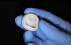 US scientists announce 3D heart printing breakthrough