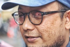 Prosecutors reject defense arguments in Novel acid attack case