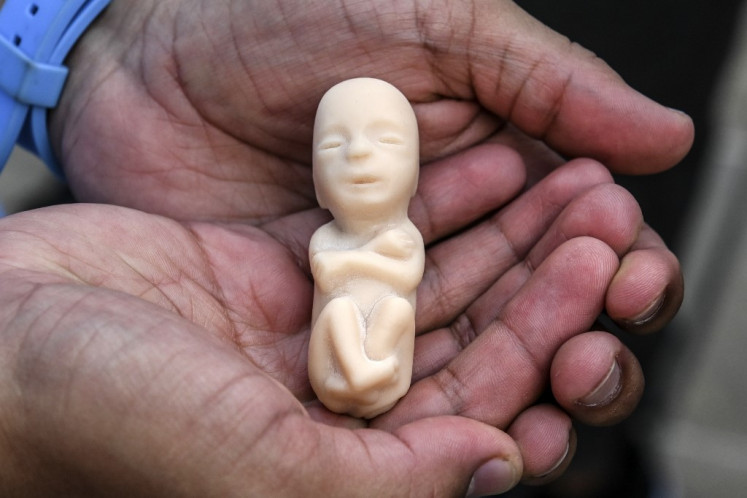 A man holds a replica of a fetus during a protest against the legalization of abortion in Medellin, Colombia, on February 19, 2020.