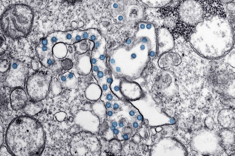 An isolate from the first U.S. case of COVID-19, formerly known as 2019-nCoV or novel coronavirus, is seen in a transmission electron microscopic image obtained from the Centers for Disease Control (CDC) in Atlanta, Georgia, U.S. March 10, 2020.   