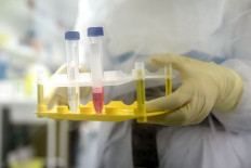 US vaccine expert says he was removed for opposing Trump-backed chloroquine