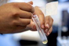 A picture taken on Tuesday shows testing equipment for infectious diseases like the COVID-19 in the Microvida laboratory in the Bravis hospital in Roosendaal, The Netherlands. Novartis and Incyte plan to test their drug Jakavi in patients with coronavirus-caused COVID-19, joining other firms including Roche and Sanofi hoping to repurpose older medicines to help critically ill patients.
