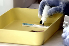 Bali puts entire village on lockdown after hundreds tested in Bangli regency