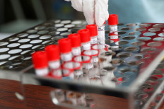 Lacking supplies, Papua’s biggest lab stops PCR testing 