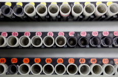 Israel isolates coronavirus antibody in 'significant breakthrough': Minister