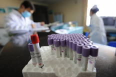 China says G4 swine flu virus not new; does not infect humans easily