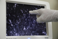 A researcher points at a microscope screen showing Sumatran Rhinoceros cells at a laboratory in International Islamic University, in Kuantan, Malaysia June 30, 2020.