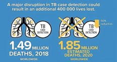 COVID-19 causes major setbacks for RI as TB high burden country