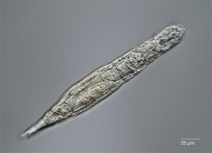 A microscopic animal called a bdelloid rotifer came back to life after being frozen for 24,000 years in Siberia and then successfully made clones of itself.