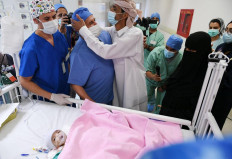 Doctors in Saudi separate Yemeni baby from twin